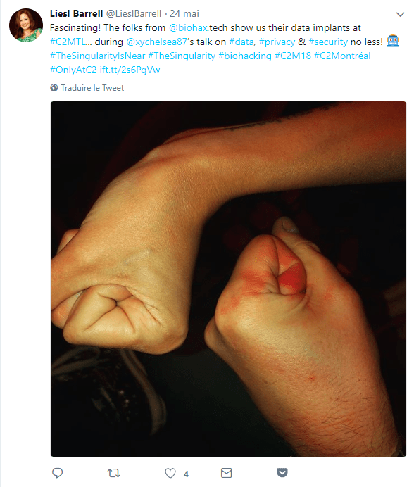 5 - fist